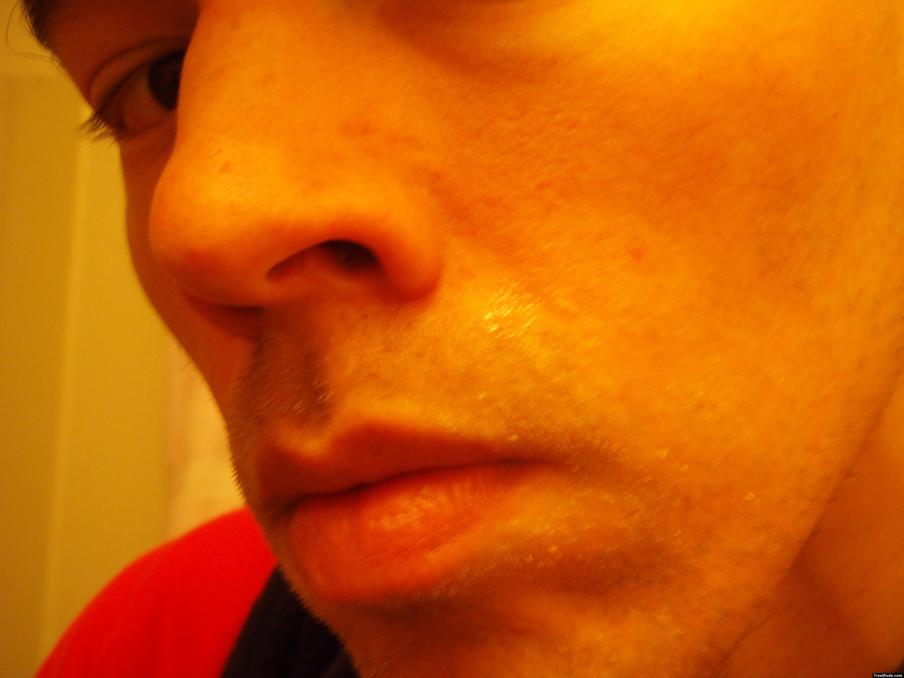 whiskers