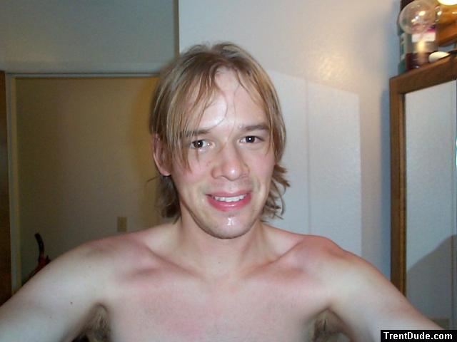 red burns