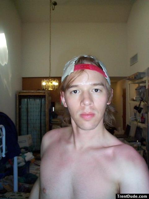 After a sunburn 5
