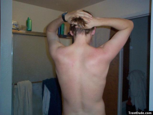 Showing off the sunburn.  ouch