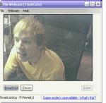 loosing his hair