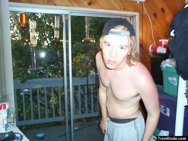 After a sunburn 2