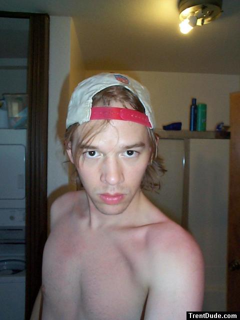 After a sunburn 4