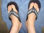 feet in Quiksilver slippers, showing veins