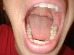 Teeth