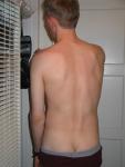Back and briefs