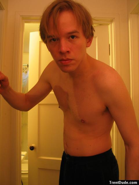 medium Long hair, fat belly