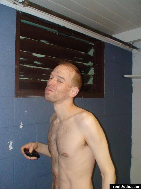 Duct tape on his forehead and ears (duct tape occlusion therapy DTOT to make the skin smooth)