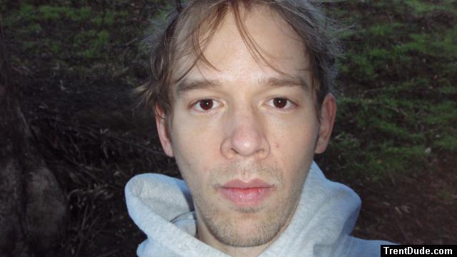 Trent Face with a pimple