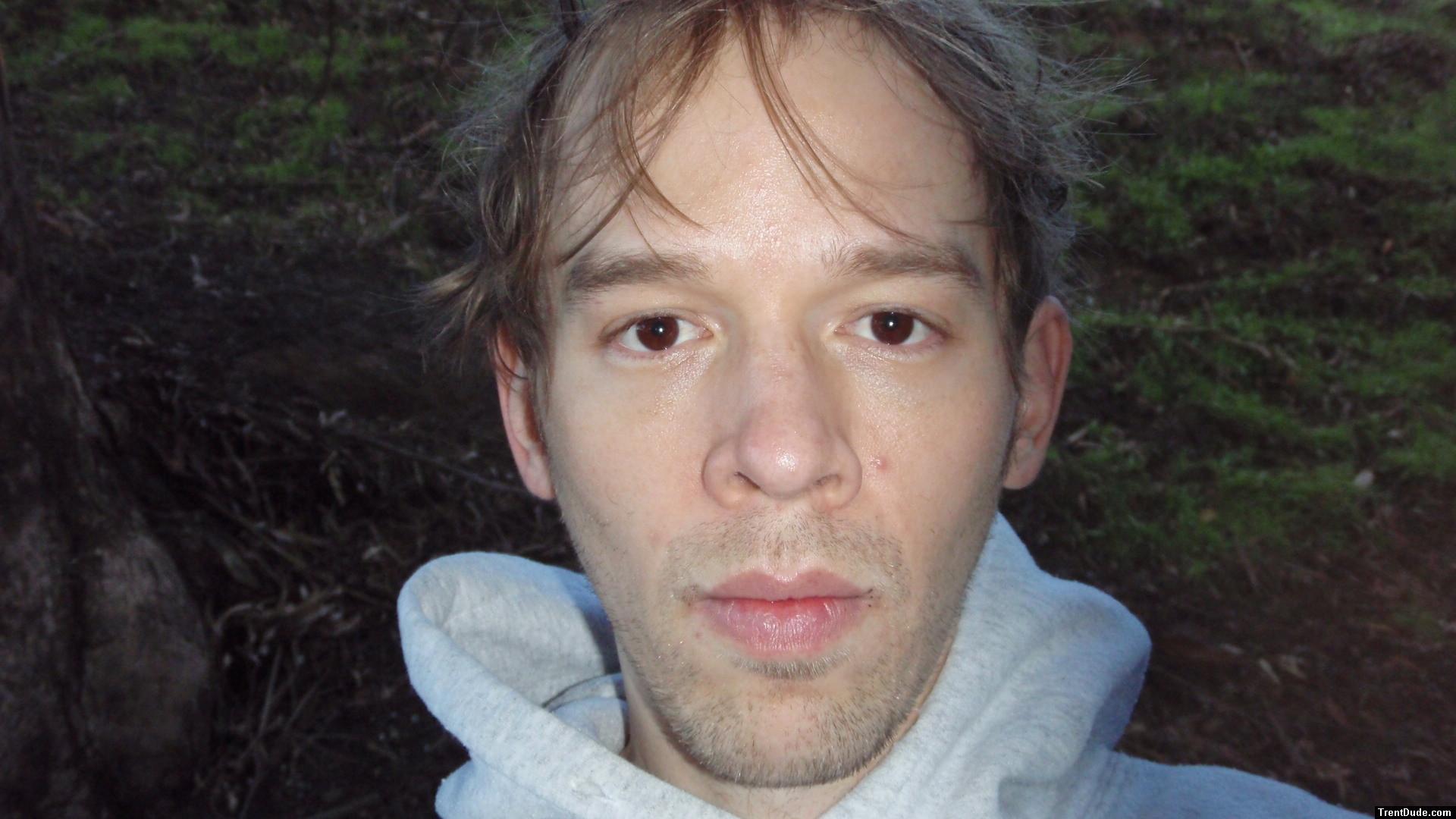 Trent Face with a pimple