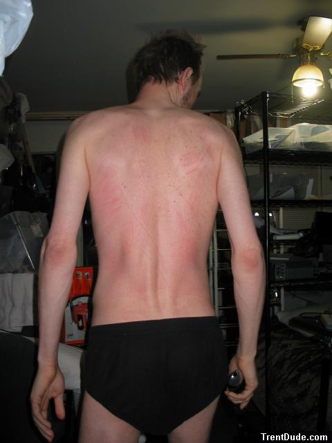 Red back from a warm shower