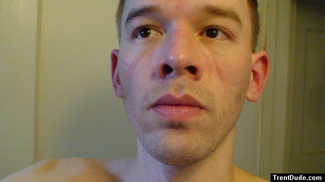 beard