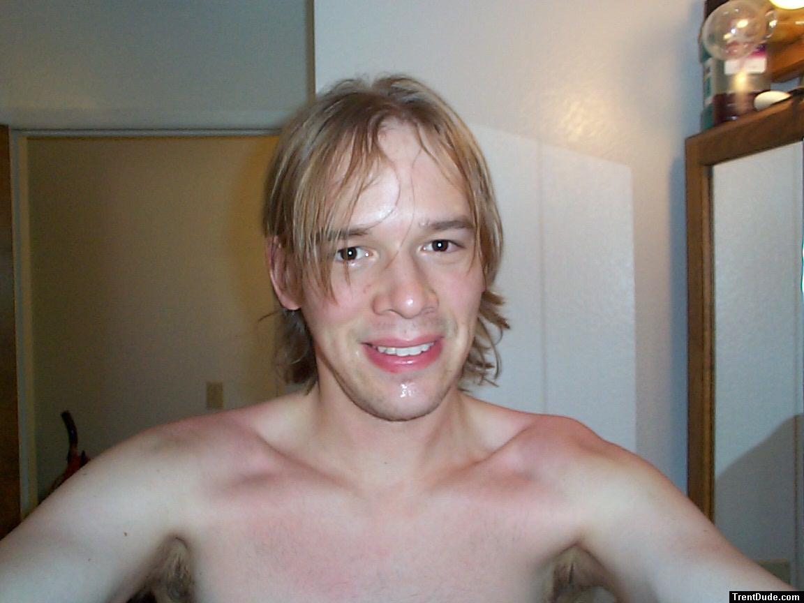red burns