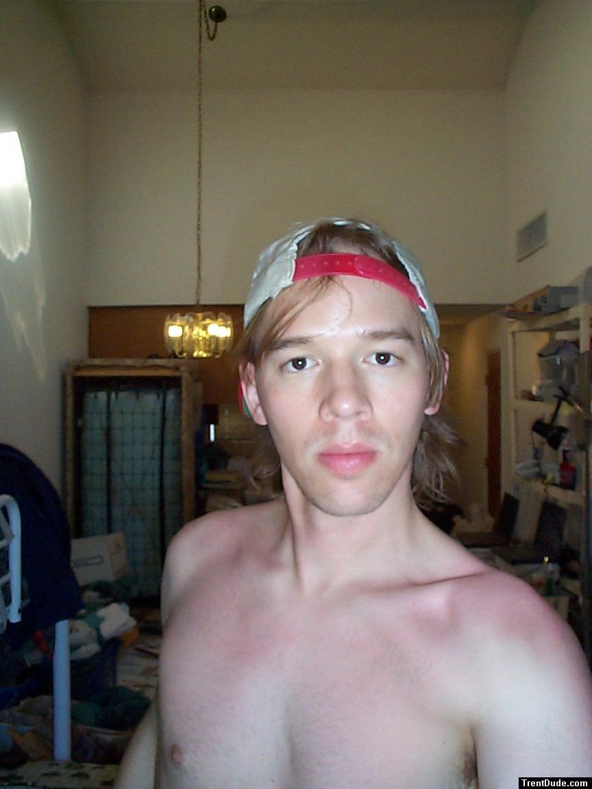 After a sunburn 5