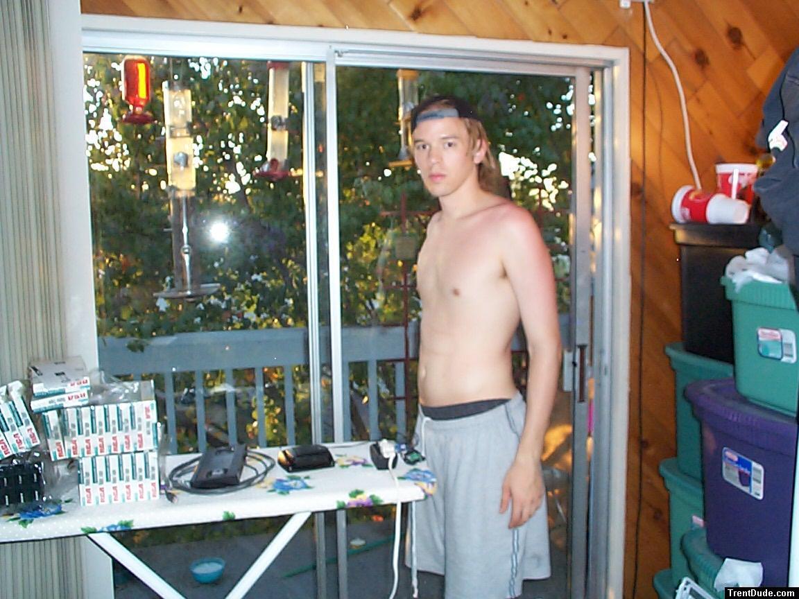 After a sunburn 3