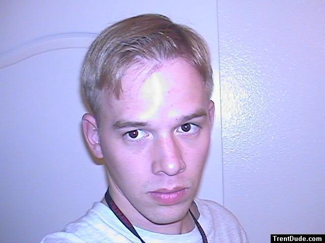 cowlick hair
