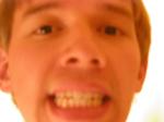 Trent teeth