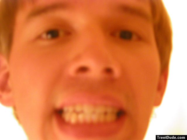 Trent teeth