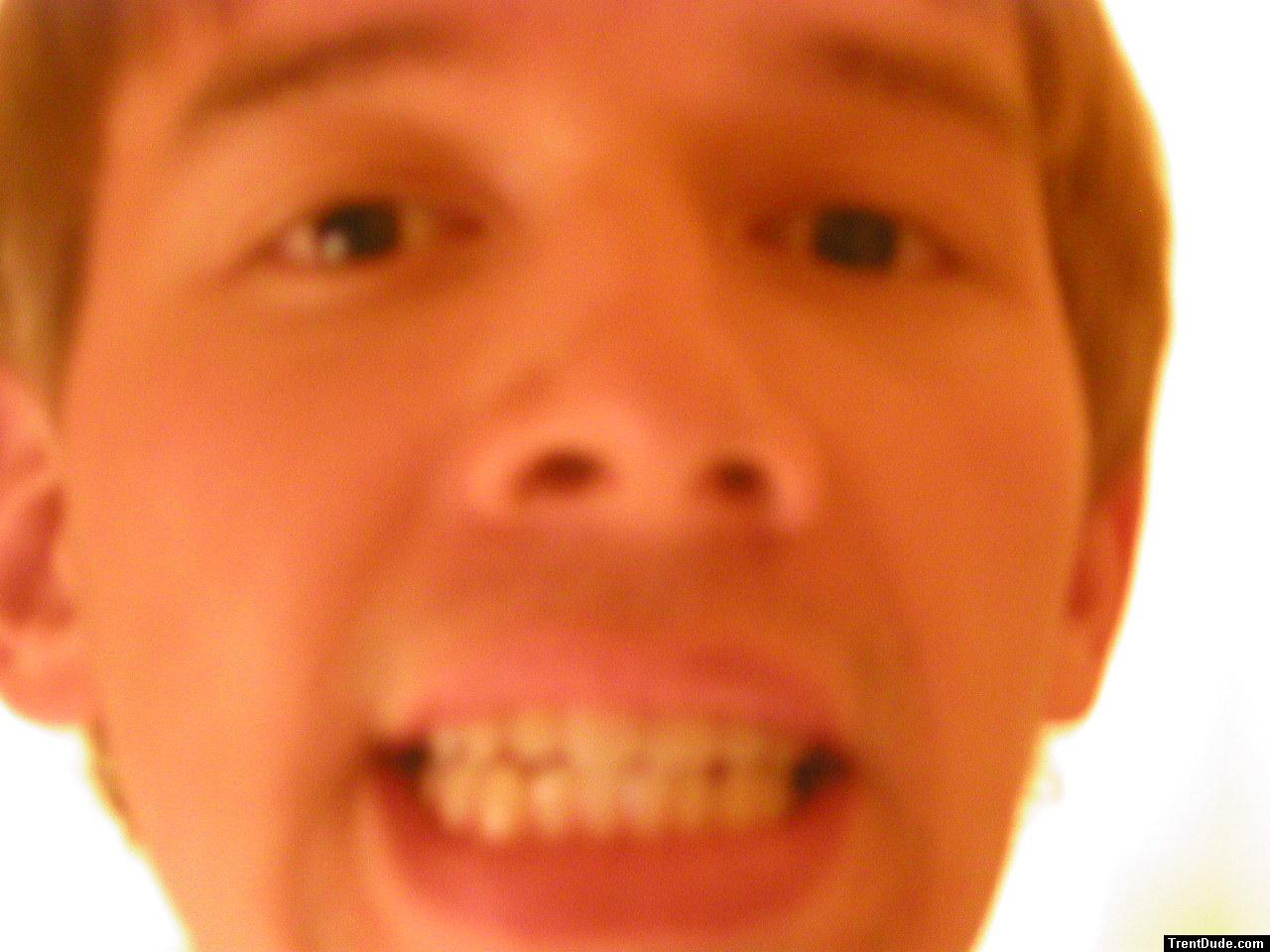 Trent teeth