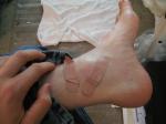 Foot with bandaids.  He learned his lesson, never go barefoot!