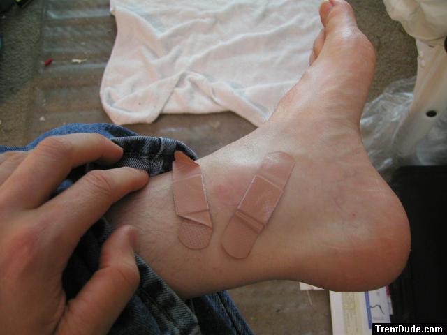 Foot with bandaids.  He learned his lesson, never go barefoot!