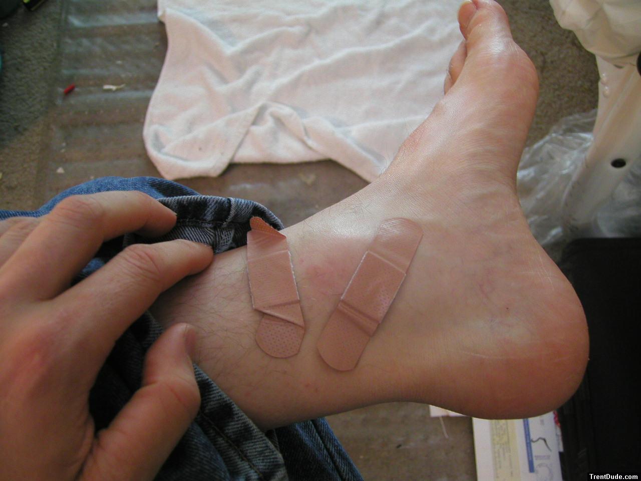 Foot with bandaids.  He learned his lesson, never go barefoot!