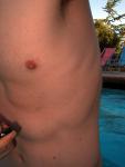 Nipples