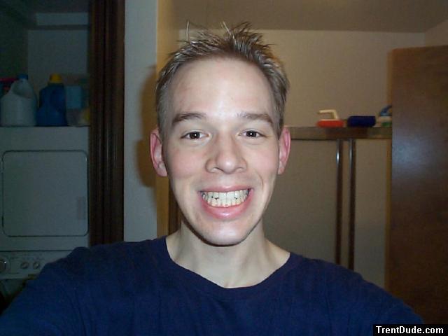 trent big smile
